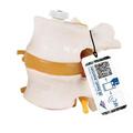 3B Scientific 2 Lumbar Vertebrae W/ Prolapsed Disc, Flexibly Mnted W/3B Smart Anatomy 1000152